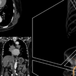 Detectando variabilidade anatômica